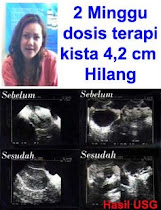 KISTA  SEMBUH (KLIK GAMBAR)