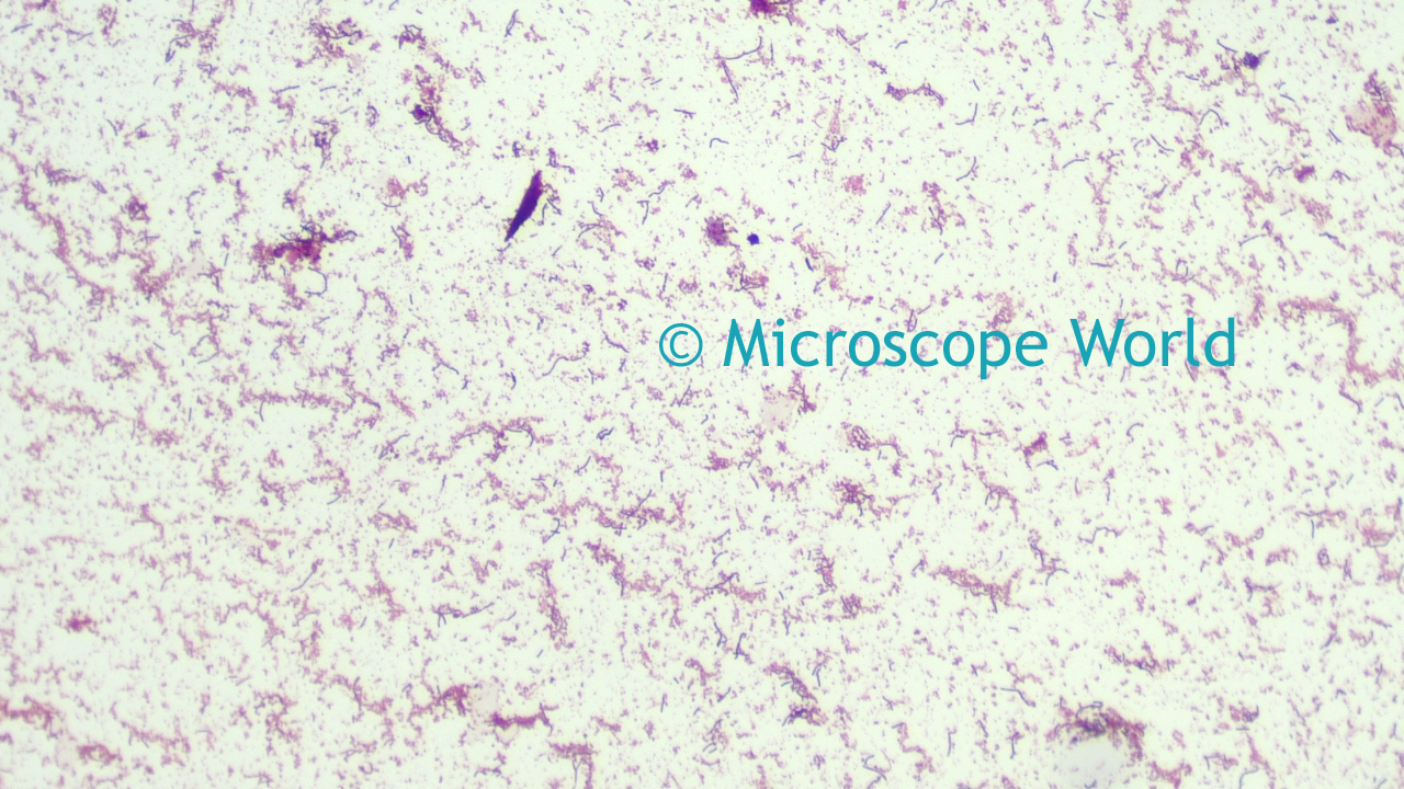 Microscope World Blog June 15