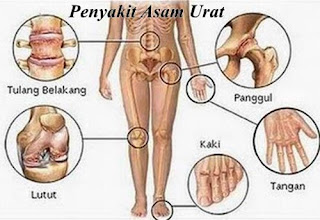 Obat asam urat untuk kaki bengkak, cara mengobati asam urat dengan baking soda, asam urat cek darah, buah menurunkan asam urat dan kolesterol, pengaruh asam urat terhadap ginjal, jamur pantangan asam urat, cara untuk mengobati asam urat, gejala asam urat tinggi dan pengobatannya, apa penyebab asam urat dan rematik, cara menghilangkan rasa sakit karena asam urat, asam urat dan cara penyembuhannya