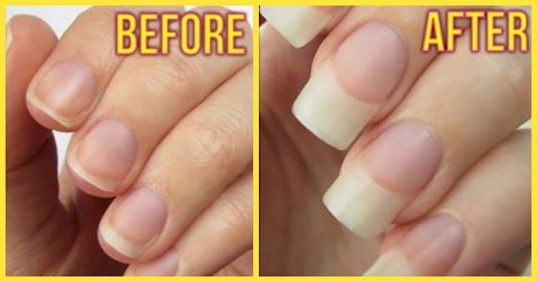 ehmkay nails: Checkered Nail Art