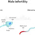 Expert list causes of infertility in men