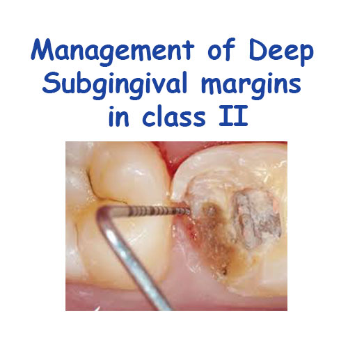 Management of deep gingival margins in class II cavity