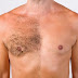 How To Remove Chest Hair Permanently