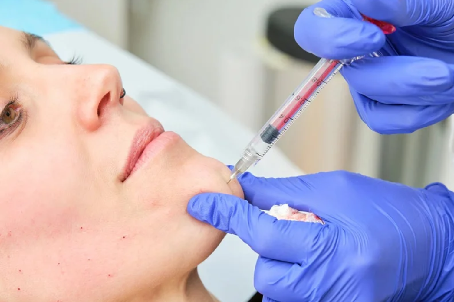 Chin Botox: Slim Down Your Face with this Noninvasive Treatment