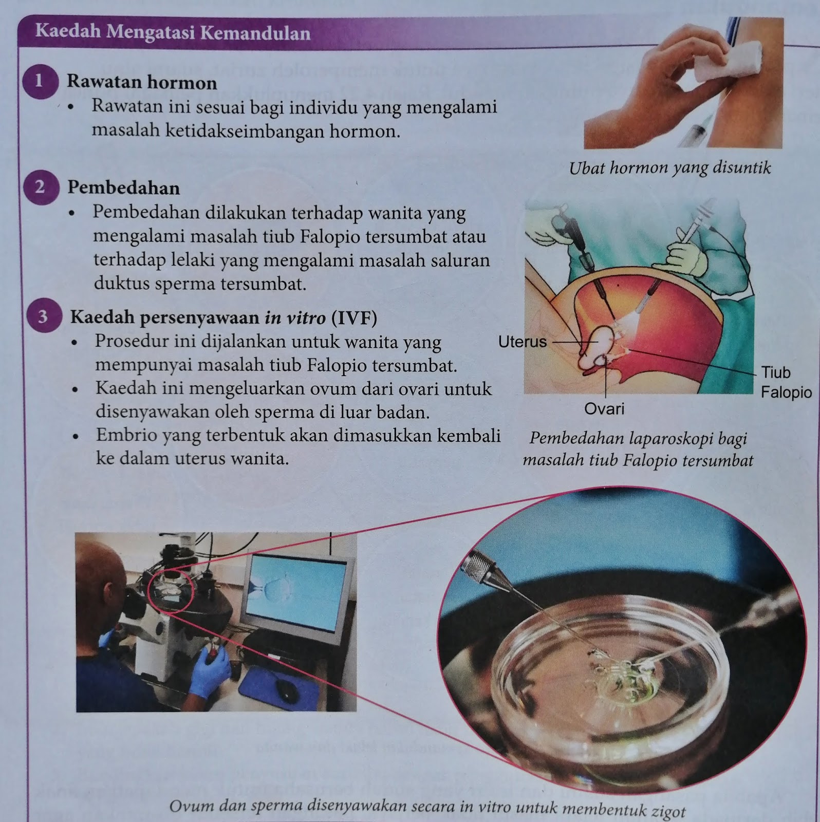 Kemandulan; Apa Punca dan Kaedah Mengatasinya?