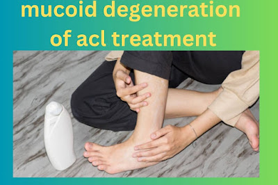 mucoid degeneration of acl treatment