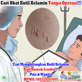 Obat Kutil Kelamin