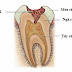 Sâu răng là gì? Phân tích 3 mức độ sâu răng