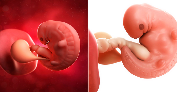  Pregnancy symptoms 6 week