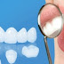 Tìm hiểu nguyên nhân gây hôi miệng khi bọc răng sứ