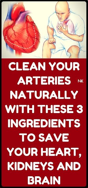 How to clean out plaque in arteries – 3 ingredients mixture