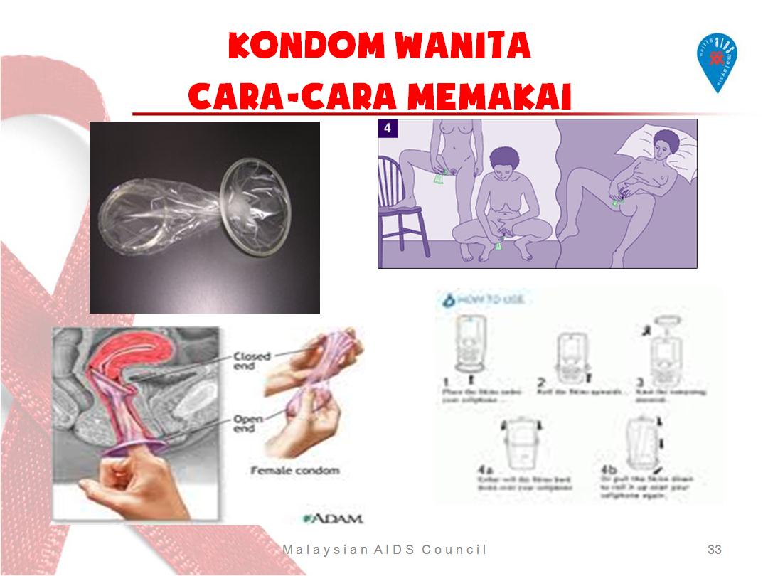 AKU HIV POSITIF CARA CARA MENGGUNAKAN KONDOM WANITA