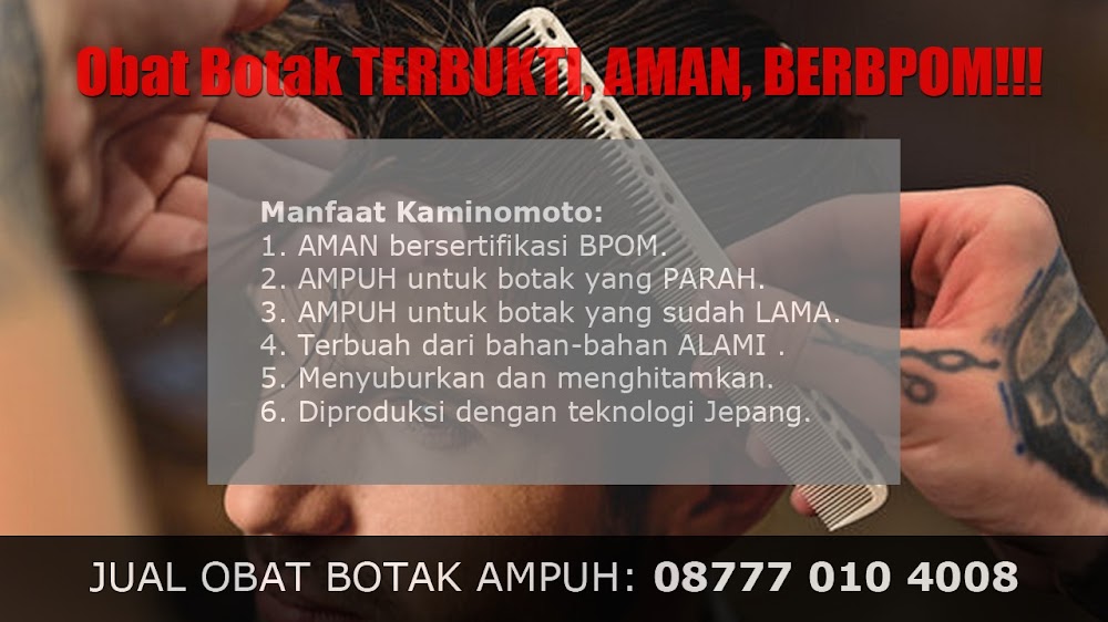 CARA MENUMBUHKAN RAMBUT KARENA FAKTOR KETURUNAN<br/>Genteng<br/>