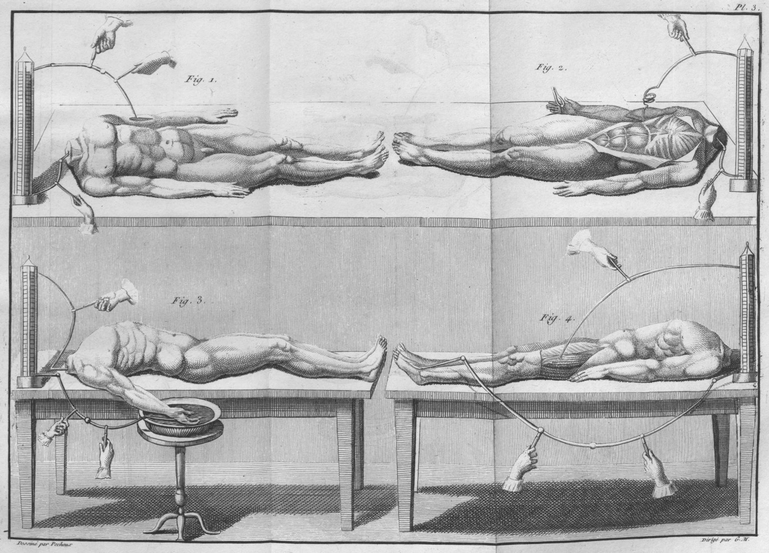 Experiments with headless cadavers