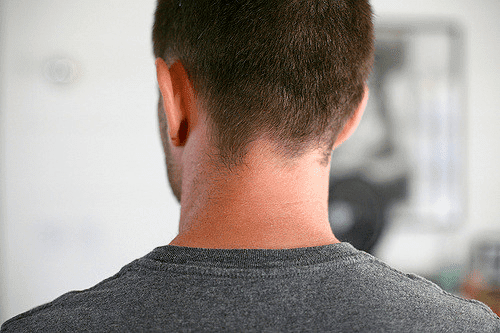 back-of-head-and-neck-pain