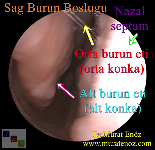 alt burun eti - alt konka - orta burun eti - orta konka - nazal septum