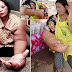 [Gambar] Wanita derita penyakit misteri, miliki tangan terbesar di dunia