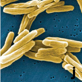 Bakteri tuberculosis