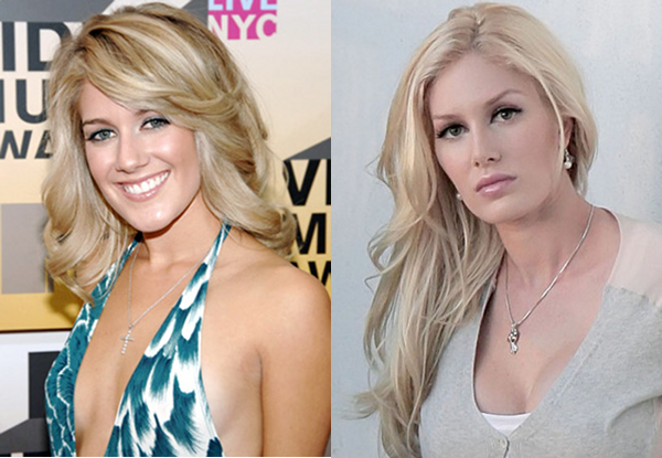 heidi montag before and after all. heidi montag before and after.