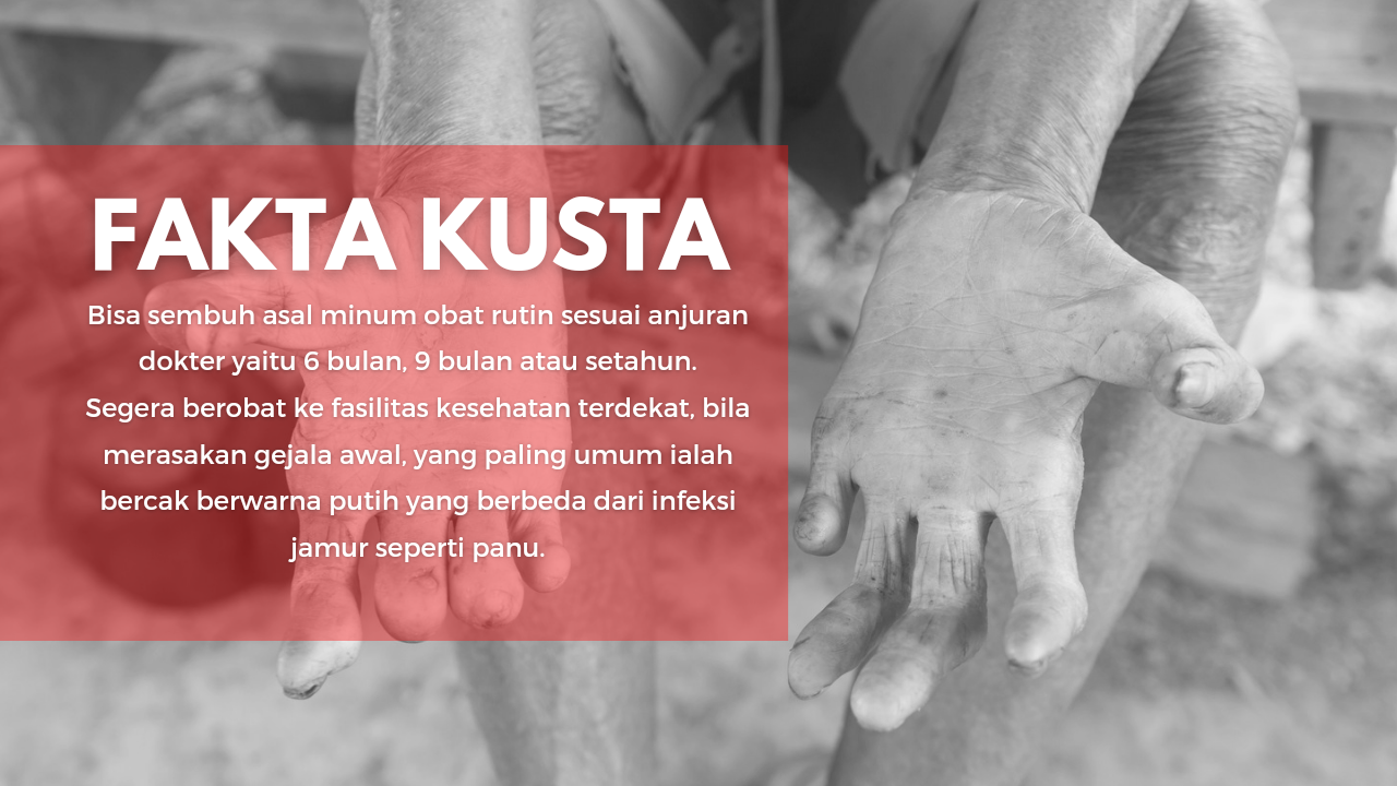 Kusta-dapat-disembuhkan