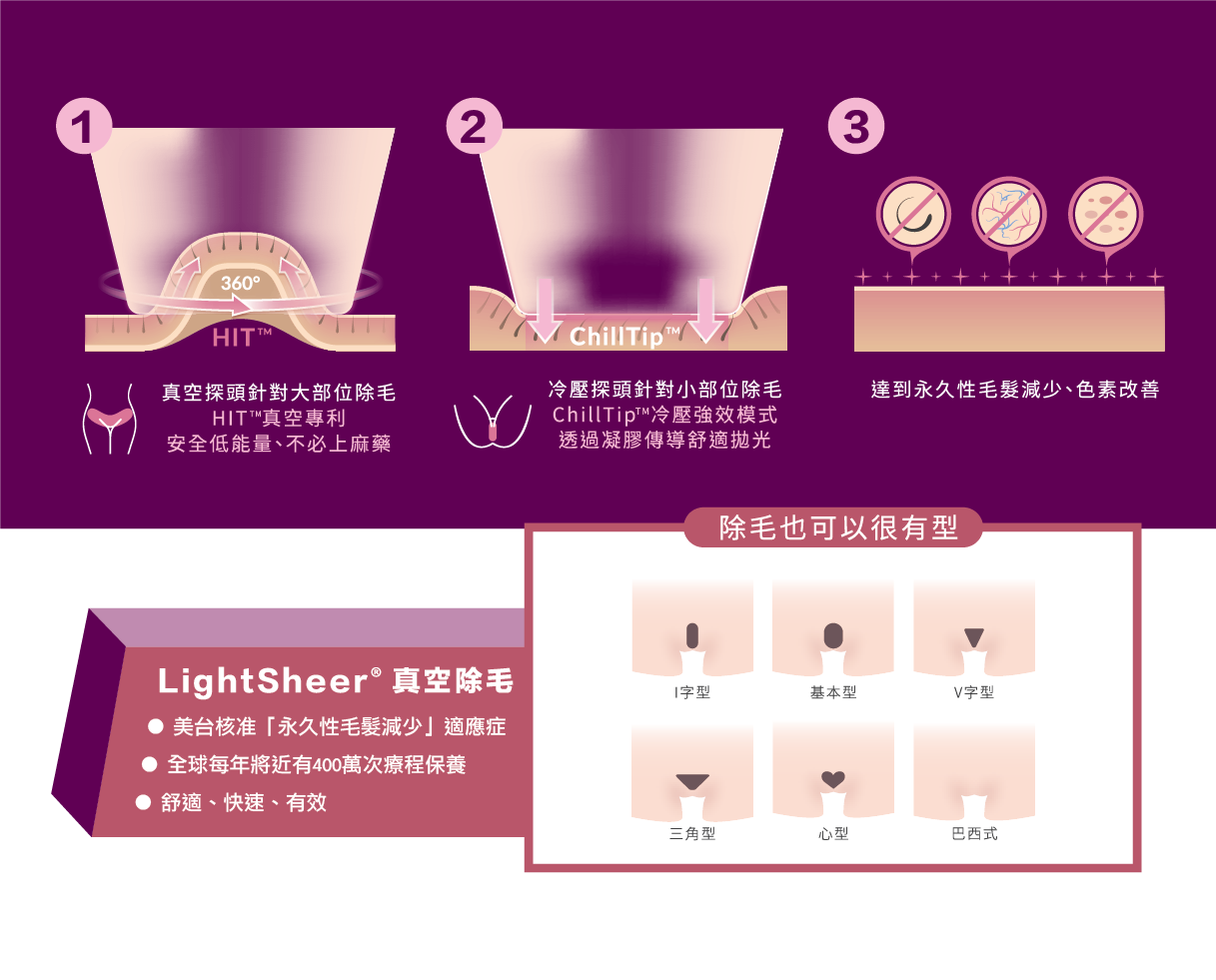 真空除毛雷射除毛私密處除毛比基尼線lightsheer除毛