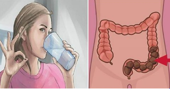 Drink This Recipe Before Going To Sleep And You Will Empty Your Colon Of Everything You Have Eaten During The Day