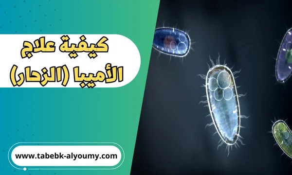 كيفية علاج الأميبا الزحار بشكل فعال ونهائي