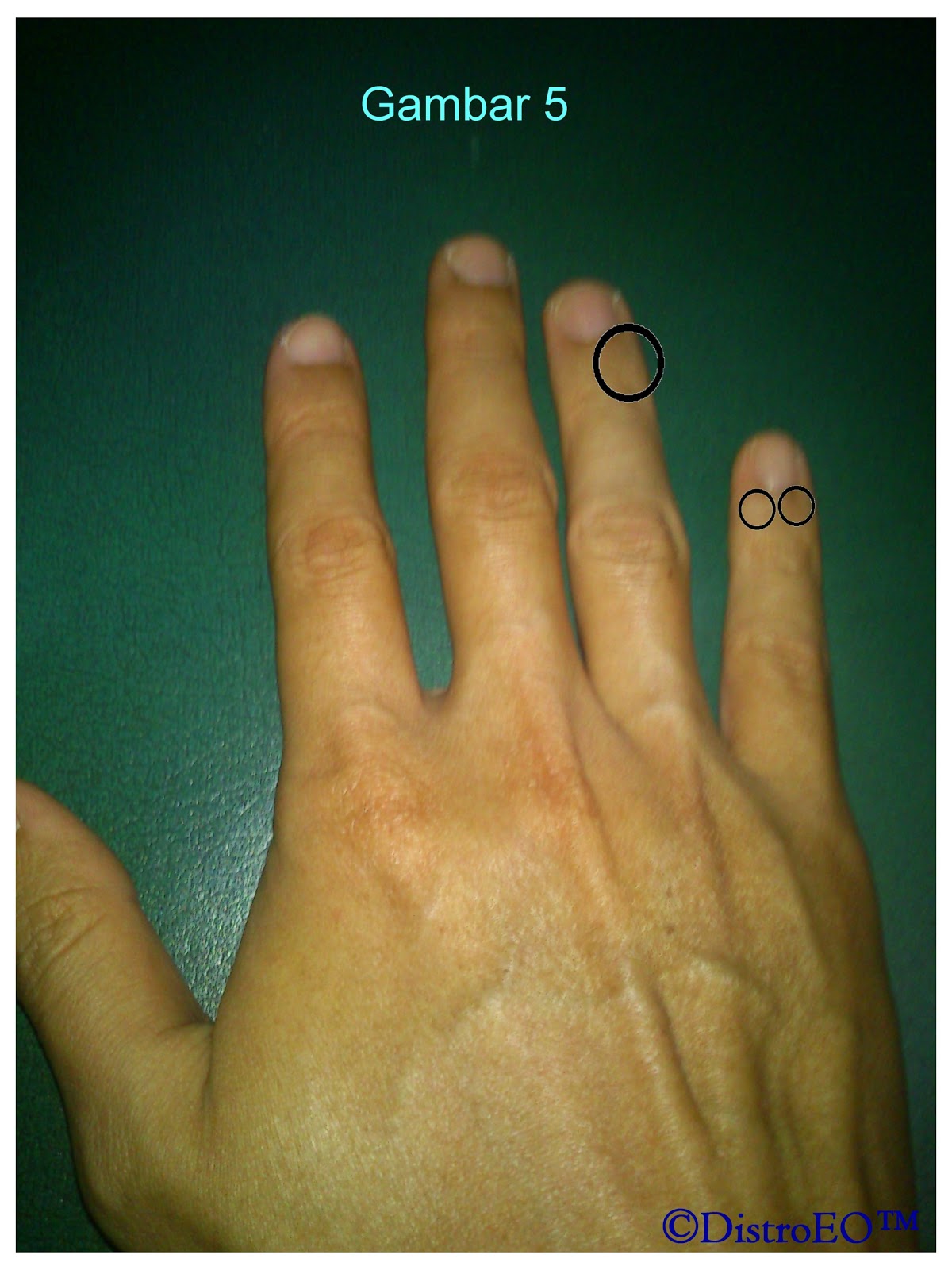 Bagi Rahasia: Titik Telapak Tangan (3T) dan manfaatnya Orgonite 3T