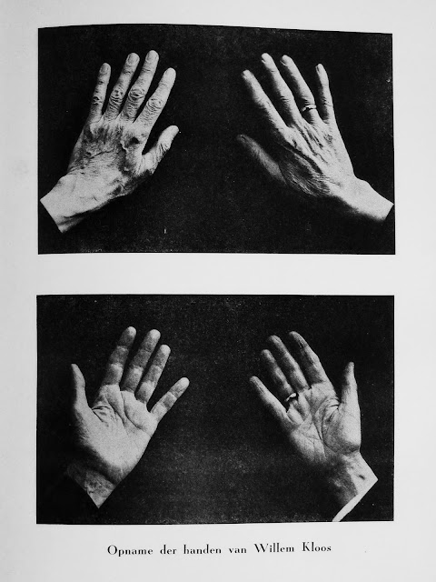 Opname der handen van Willem Kloos. Uit: Het menschelijke beeld van Willem Kloos, Jeanne Reyneke van Stuwe