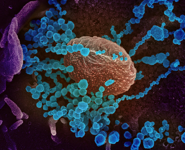 Coronavirus(COVID-19) cases in India