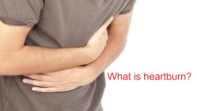 Causes, Symptoms And Treatment Of Heartburn