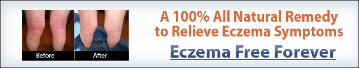 Eczema free forever