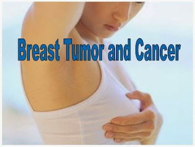 How to Differentiate Lumps in Breast Tumor and Cancer