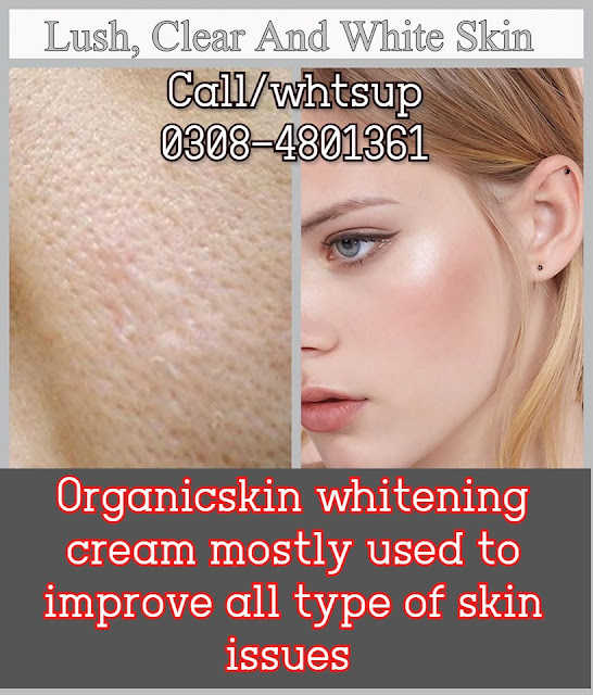 best-skin-whitening-creams-in-pakistan