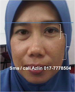 Premium Beautiful Bioever Tip Awet Muda Wajah Berseri Cara Mengatasi Jerawat