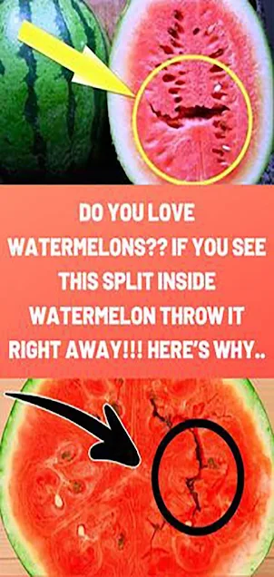 Do You Love Watermelons?? If You See This Split Inside Watermelon Throw It Right Away!!! Here’S Why..