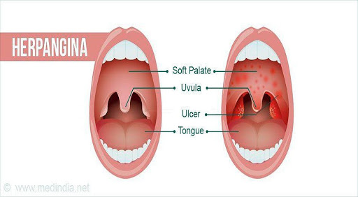 Medicina Bucal