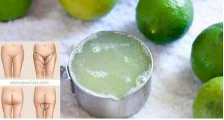 krim hilangkan hitam di celah kelangkang