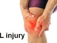  ACL injury