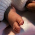   Nace un bebé con 2 penes y sin ano en Pakistán 