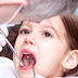Giai đoạn nào của trẻ phù hợp để niềng răng