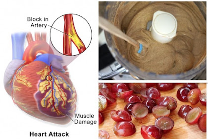 5 Foods You Should Be Eating After A Heart Attack To Save Your Life