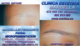 micropigmentyación Granada clínica estetica propone los mejor precio para micropigmentyación, maquillaje permanente de cejas en Granada y marbella