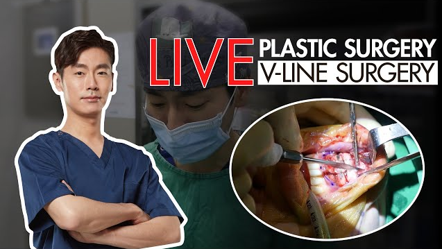 LIVE plastic surgery