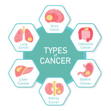 WHAT IS CANCER? TYPES , CAUSES, SYMPTOMS, WHY IS CANCER SO DEADLY? DIAGNOSIS, TREATMENT