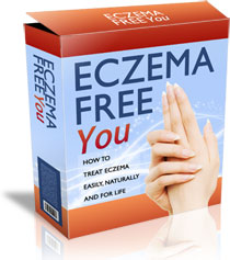 5 Natural Ways to Fight Off eczema natural remedy for baby