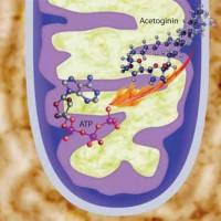 picture of mesothelioma