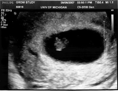 ultrasounds at 8 weeks. Ultrasound at 8 weeks