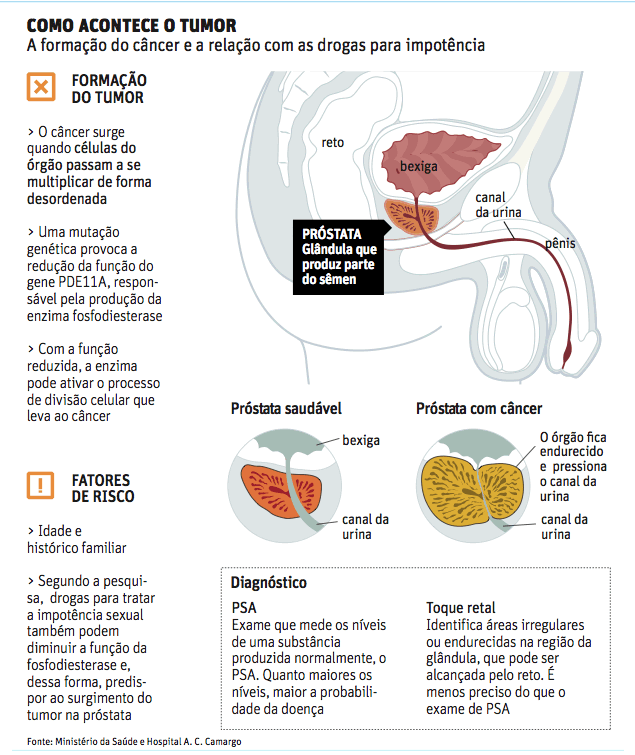 Droga anti-impotência é ligada a tumor na próstata, sugere pesquisa