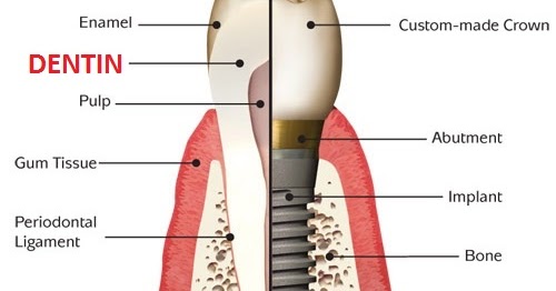 Hipersensitif Dentin Psychologymania